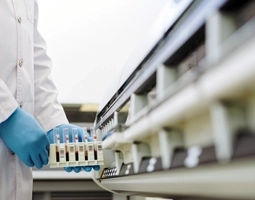 BCL tekercses címkenyomda