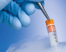 Felhasználási területek tekercses címkenyomda Cryo címke